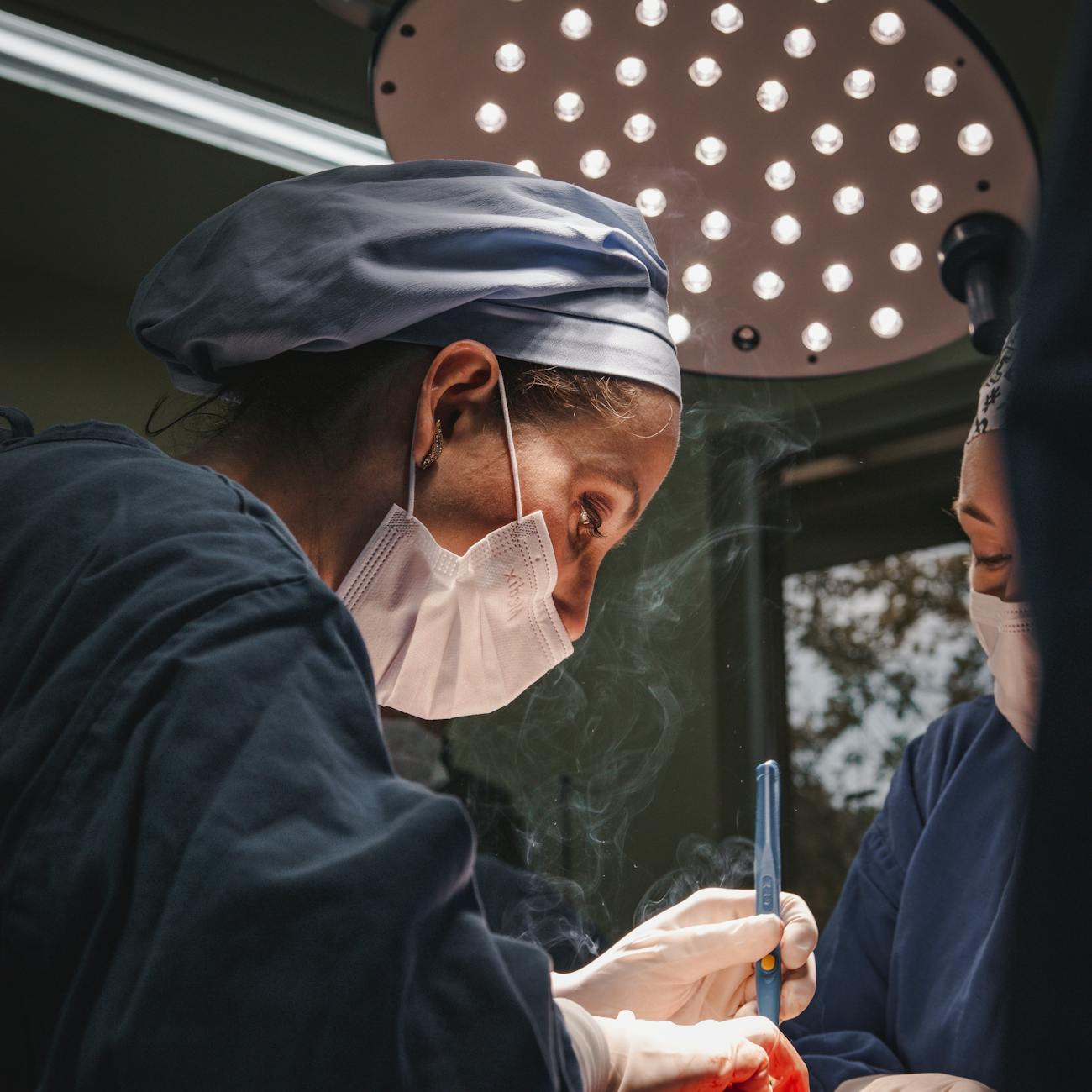 Surgical Hair Loss Solutions