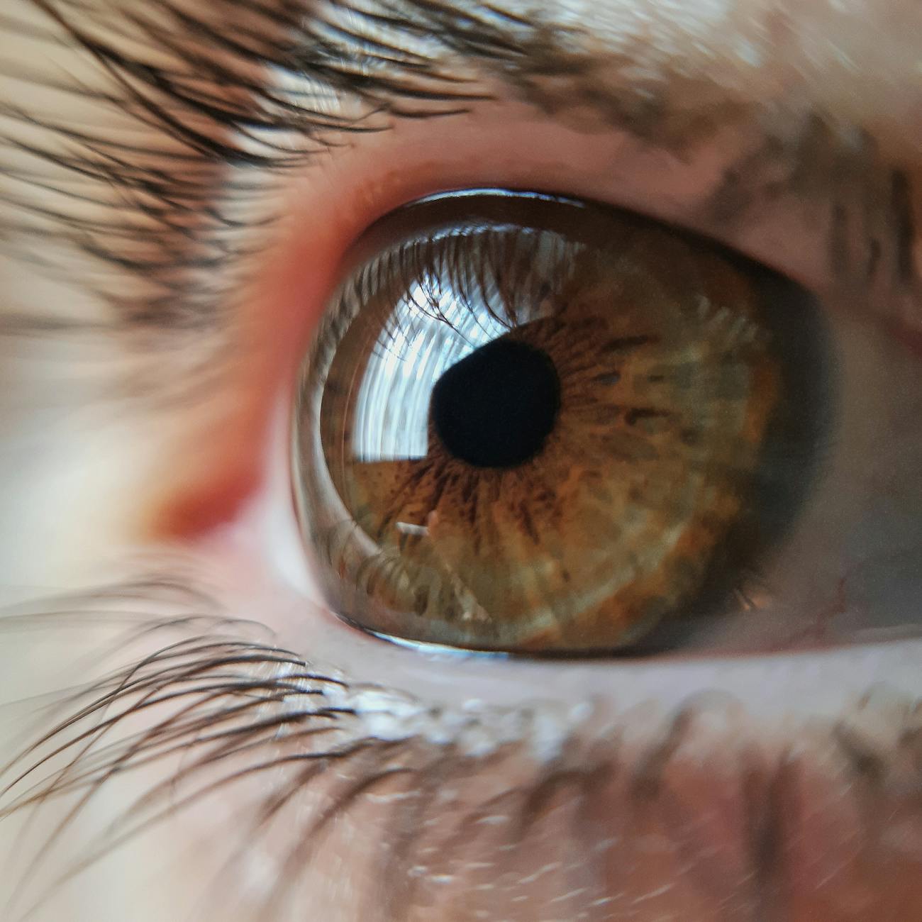 Imaging Modalities in Ocular Oncology