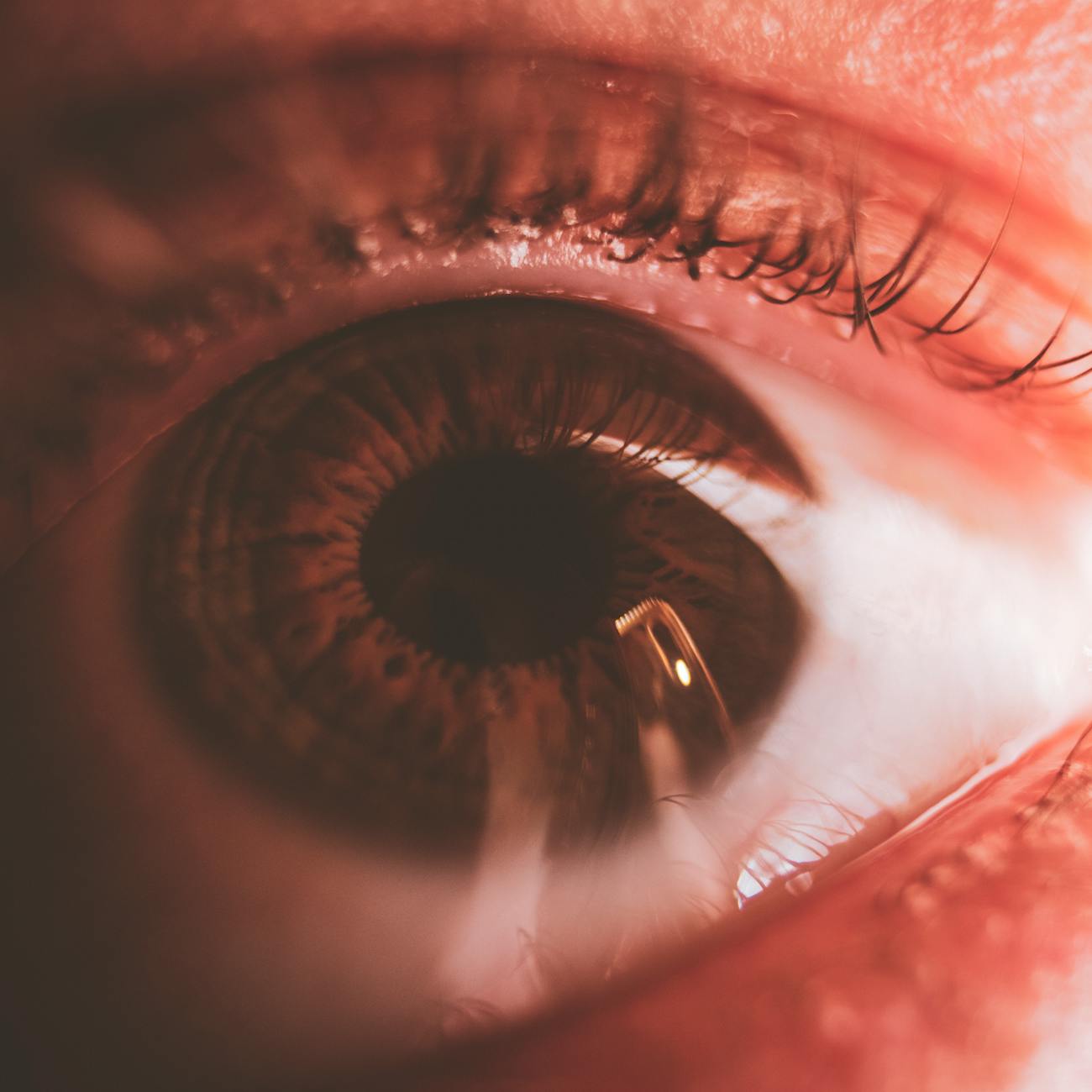 Pediatric Ocular Tumors