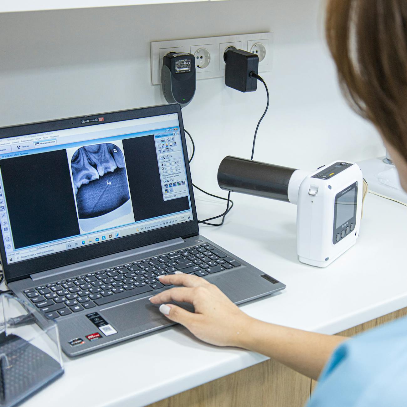 Lung Ultrasound in Critical Care